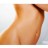 Tummy Tuck
