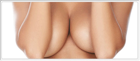 Breast Reduction Breast Reduction